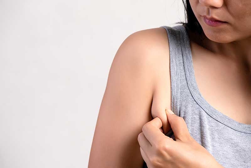 Woman squeezing her armpit fat or accessory breast