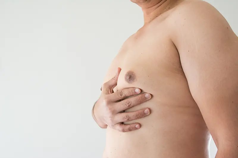 Fat Freeze For Gynecomastia