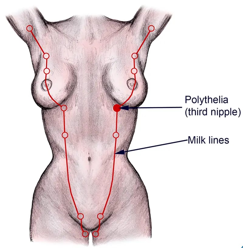 Embryonic milk lines