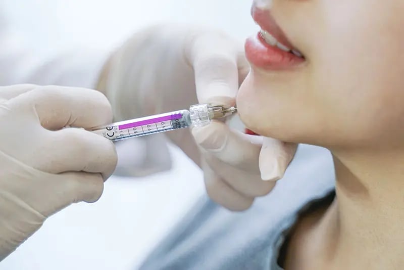 How Long Do Fillers Last? What affects dermal filler longevity?