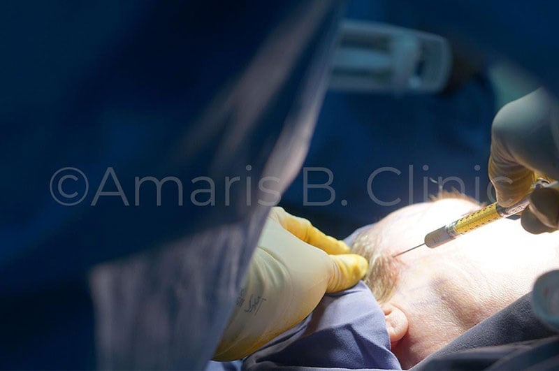 Facial Enhancement with Fat Grafting with Dr Ivan Puah
