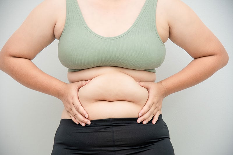 Bad botched liposuction