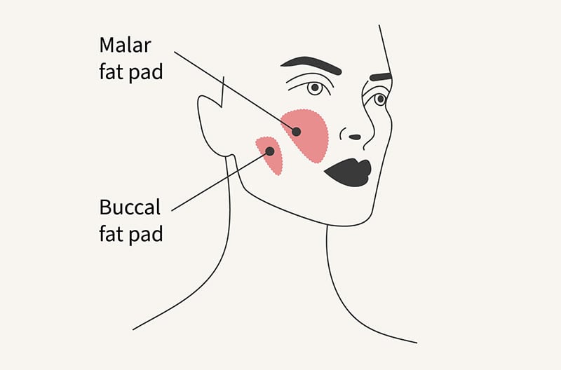 Buccal Fat Pad Diagram